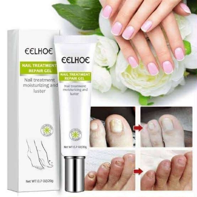 Picture of Efero Nail Repair Treatment Gel Fungus Cream-20gm (Next lavel cosmic)