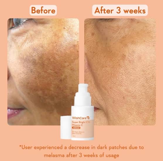 Picture of Wishcare Super Bright C16 Vitamin C Face Serum - 30 ml