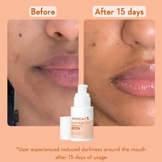 Picture of Wishcare Super Bright C16 Vitamin C Face Serum - 30 ml