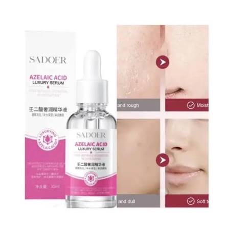 Picture of SADOER Azelaic Acid Luxurious Essence Moisturizing Shrink Pores Refreshing Skin Beauty Essence 30ml