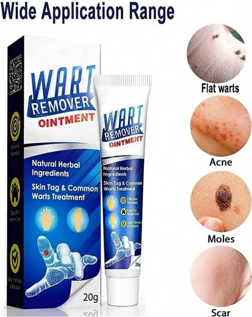 Picture of Wart Remover Ointment 20gm