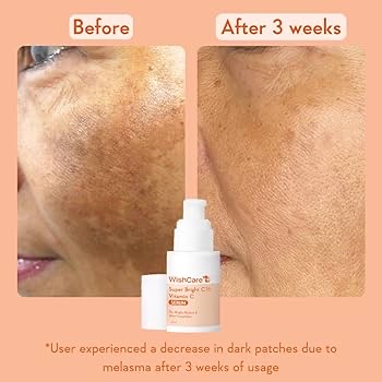 Picture of Wishcare Super Bright C16 Vitamin C Face Serum - 30 ml