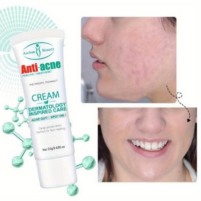 Picture of Aichun Beauty 3 Days Clear Strong Anti-Acne Cream-20gm