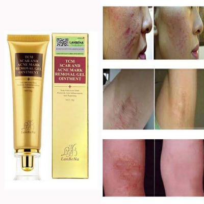 Picture of LANBENA TCM scar and Acne Spot Removal Gel Ointment