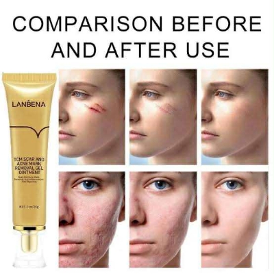 Picture of LANBENA TCM scar and Acne Spot Removal Gel Ointment