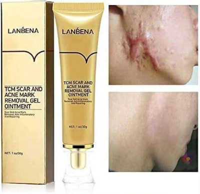 Picture of LANBENA TCM scar and Acne Spot Removal Gel Ointment