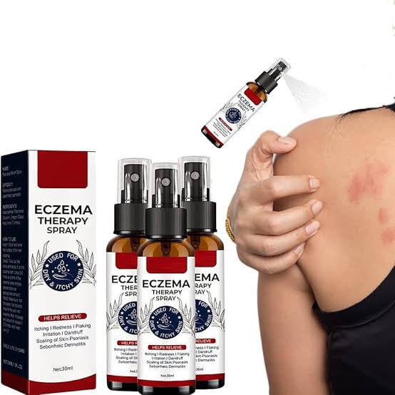 Picture of Psoriasis Relief Spray, Psoriasis Spray 2pcs Repair Skin Portable For Eczema For Skin Itch