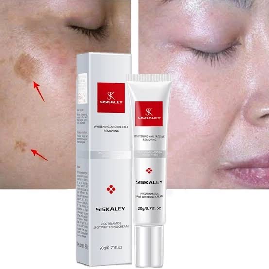 Picture of Youbuy Freckle Whitening Cream 20g Pigmentation Remover Dark Spot Remover Anti Freckles Whitening Cream