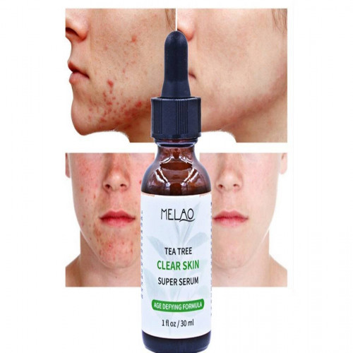 Picture of Melao Tea Tree Clear Skin Super Serum 30ml