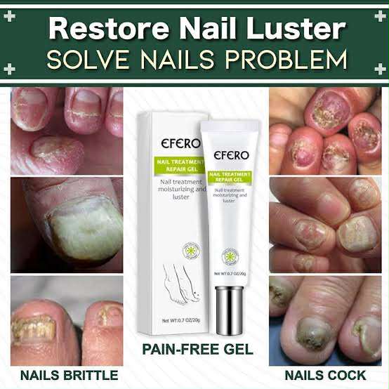 Picture of Efero Nail Repair Treatment Gel Fungus Cream-20gm