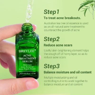 Picture of Tea Tree Acne treatment Serum- 17ml