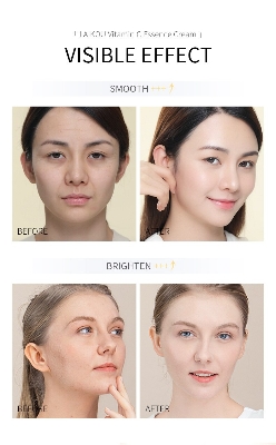 Picture of LAIKOU Vitamin C Essence Cream- 25g