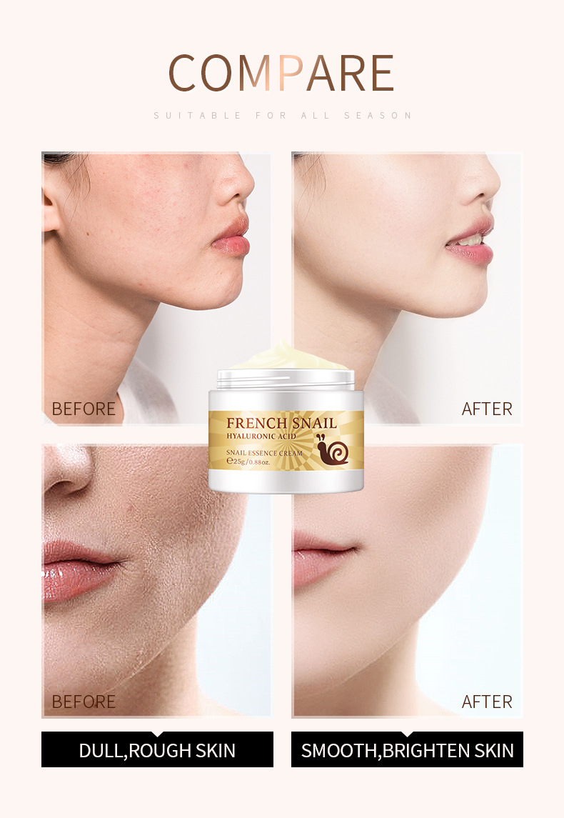 Picture of LAIKOU French Snail Hyaluronic Acid Snail Essence Cream- 25g