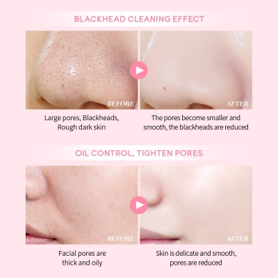 Picture of LAIKOU Japan Sakura Hydrating Pores Cleaning Mud Mask- 75g