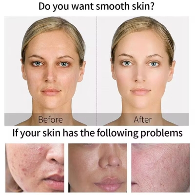 Picture of MELAO Skin Whitening Serum Organic 2% Arbutin Kojic Acid Lightening Brightening Serum- 30ml