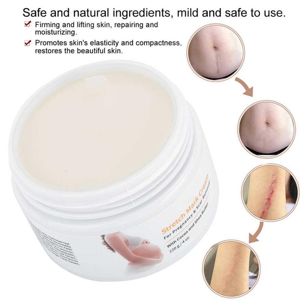 Picture of MELAO Scar Removal Cocoa & Shea Butter Stretch Mark Cream- 120g