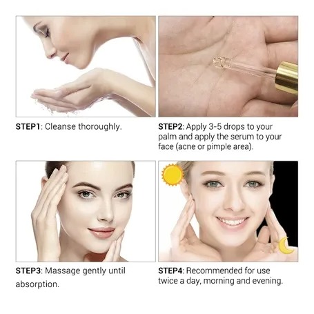 Picture of Breylee Acne Treatment Serum- 17ml