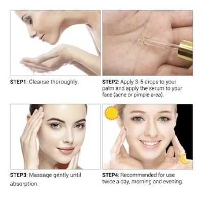 Picture of Breylee Acne Treatment Serum- 17ml
