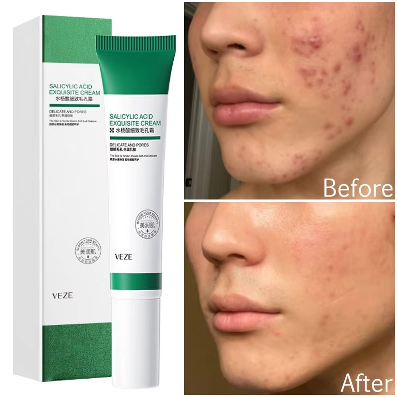 Picture of VEZE Salicylic Acid Pores Shrink Refining Cream Repair Large Open Pore Removal Cream- 20g