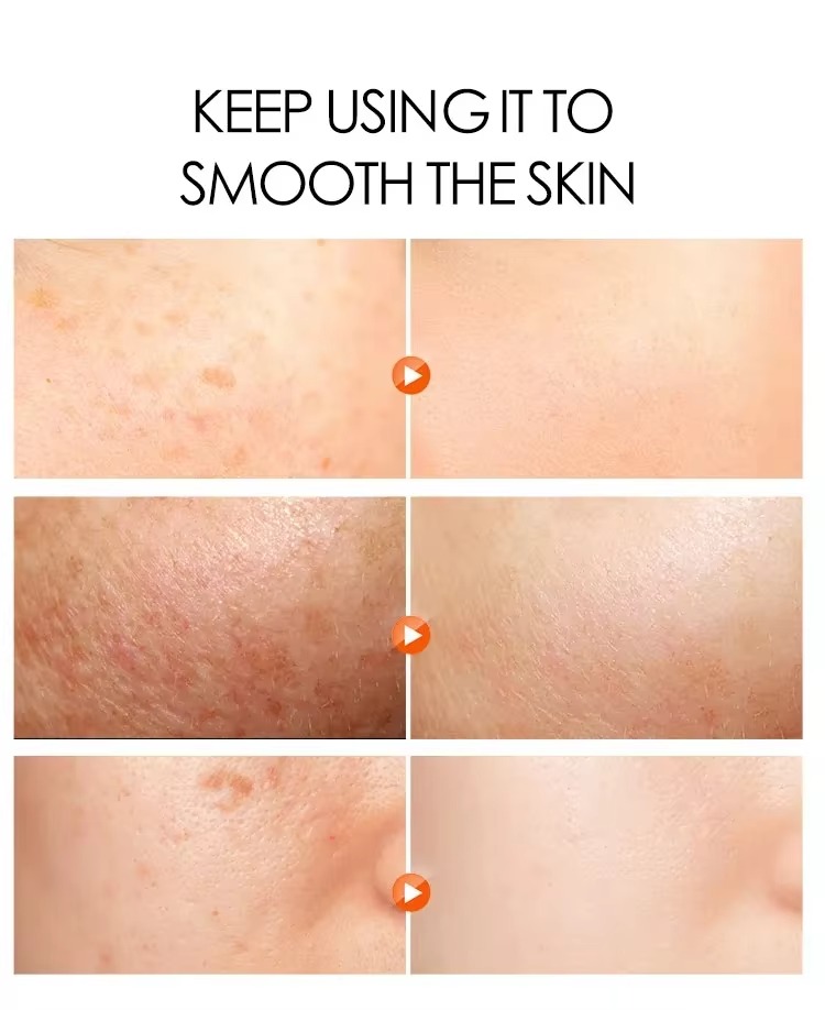 Picture of DR Rashel Fade Spots Arbutin & Niacinamide Night Cream- 50g