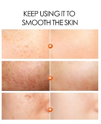 Picture of DR Rashel Fade Spots Arbutin & Niacinamide Night Cream- 50g