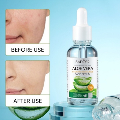 Picture of SADOER Aloe Vera Soothing Moisture & Brighter Face Luxurious Hydrating Essence- 30ml(Aloe Vera)