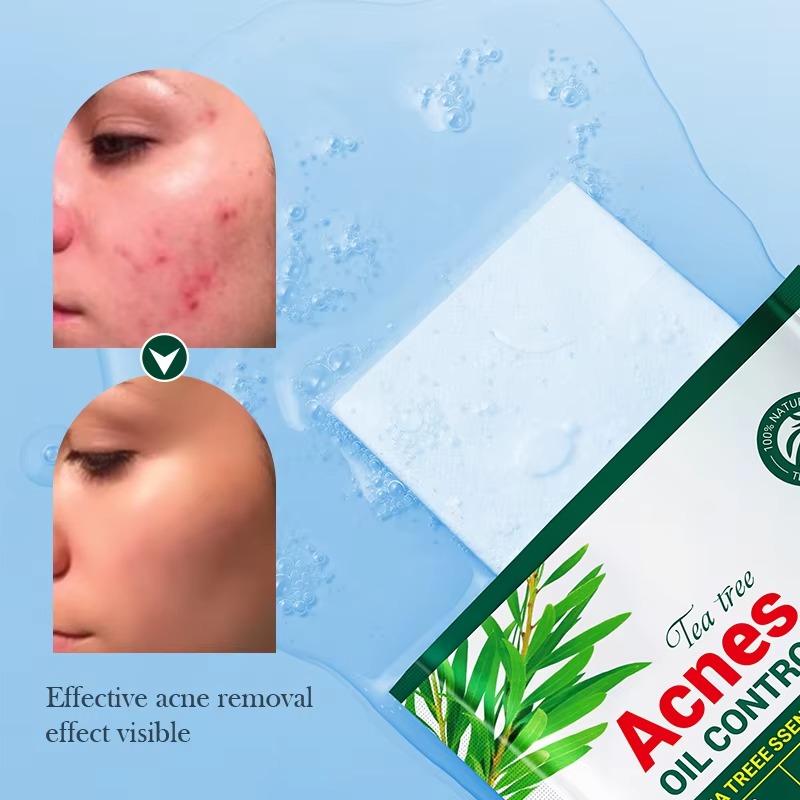 Picture of SADOER Tea Tree Acnes Oil Control Facial Sheet Mask- 25g(Tea Tree)