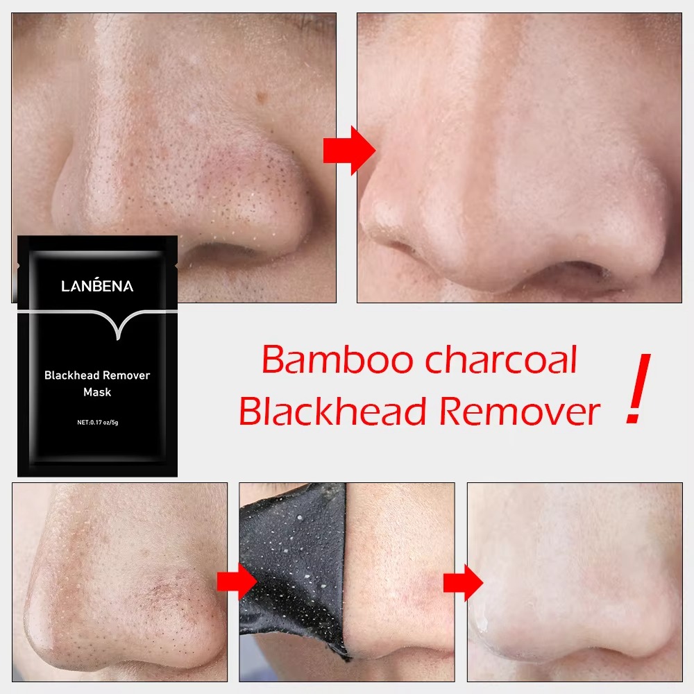 Picture of LANBENA Blackhead Remover Nose Mask- 5g