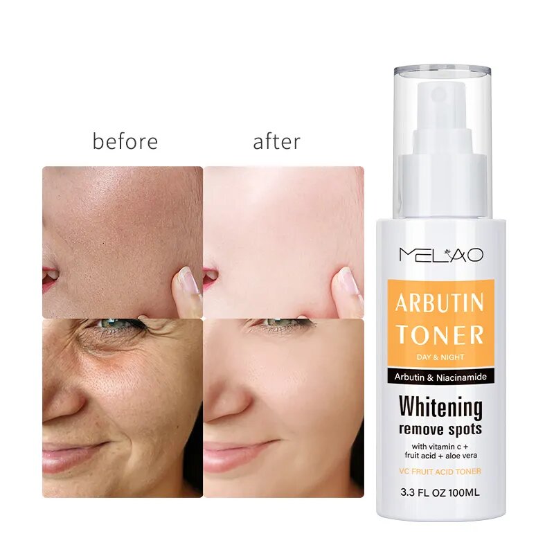 Picture of Melao Moisturizing Mist Vitamin C Whitening Arbutin Toner- & Spots Remover