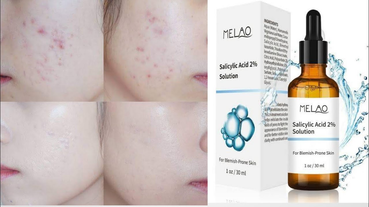 Picture of Melao- Salicylic Acid Serum 2% Concentrate For Face -30ml