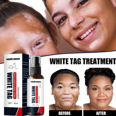 Picture of South Moon White Tag Treatment Vitiligo Therapeutic Serum Universal White Spot Cleansing Spray -30ml