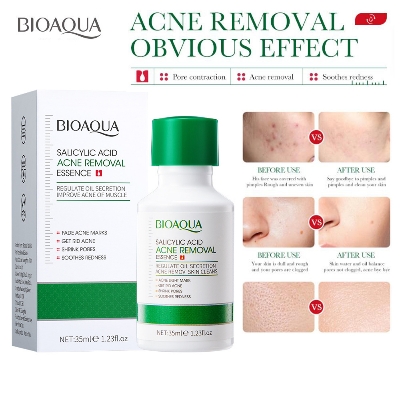 Picture of BIOAQUA Salicylic Acid Shrink Pores Face Serum Oil Control Remove Acne Blackheads Dark Spot Whitening Moisturizing Skin Care Essence -35ML