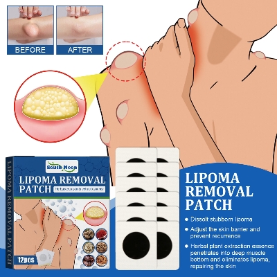 Picture of South Moon Lipoma Removal Cream Lipolysis Fat Lump Relieve Plaster Skin Swelling Ointment Subcutaneous Lumps Dredge Dissipate Body Care（20g）
