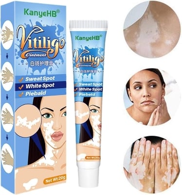 Picture of Eliminate Vitiligo Skin Care Leukoplakia Cream Herbal Extract White Spot Removal Skin Reduce Melanin