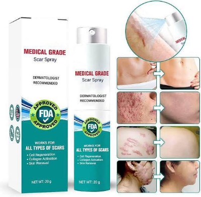 Picture of South Moon Medical Grade Scar Spray