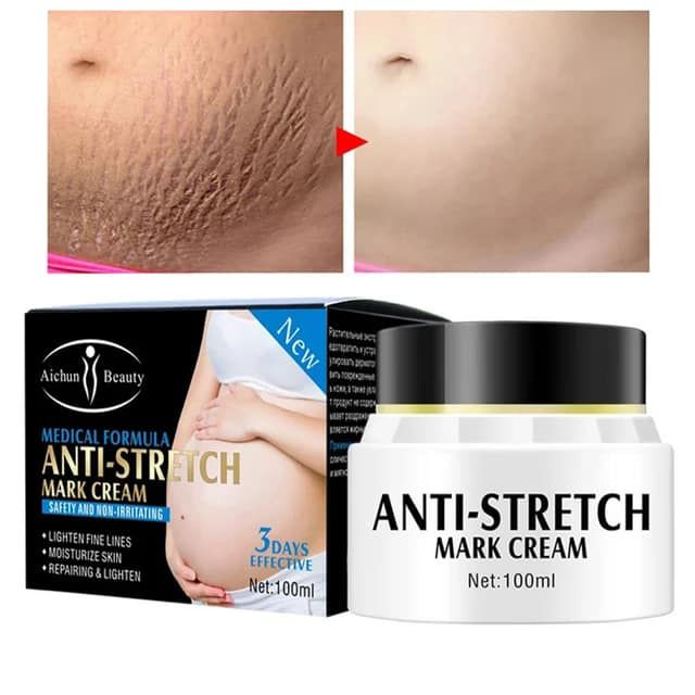 Picture of Aichun Beauty Anti-Stretch Mark Cream – Intensive Treatment – 100ml