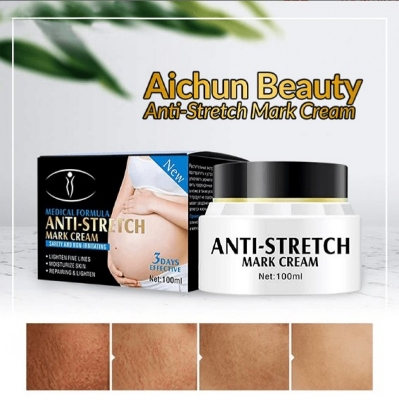 Picture of Aichun Beauty Anti-Stretch Mark Cream – Intensive Treatment – 100ml