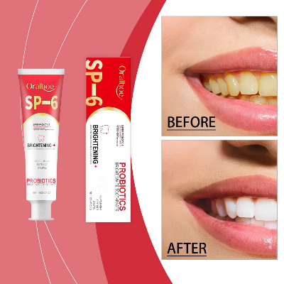 Picture of Oralhoe SP-6 Super Probiotic Bright White Toothpaste - 120g/4.23oz