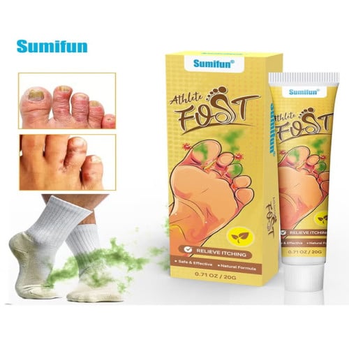 Picture of Athlete Foot Relieve Itching, Antibacterial Cream, Ointment for Burning 20g