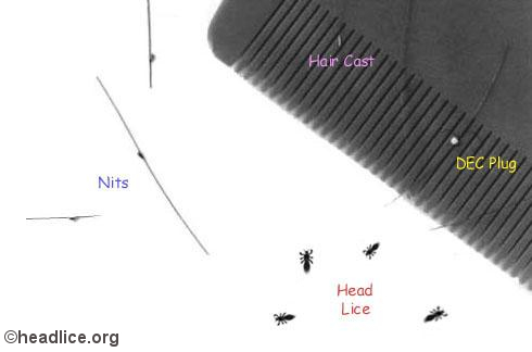 Picture of 2 pieces  Lice Removal Comb Combo  - Best for Ladies Girls Hair lice removal  (Hair Brush) -Multicolor