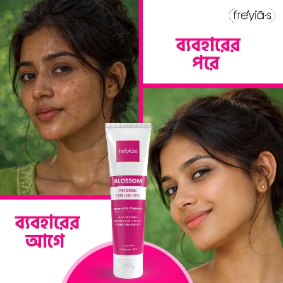 Picture of Freyia’s Blossom Intense Peeling Gel 100ml (Short Expiry: June 2026) White