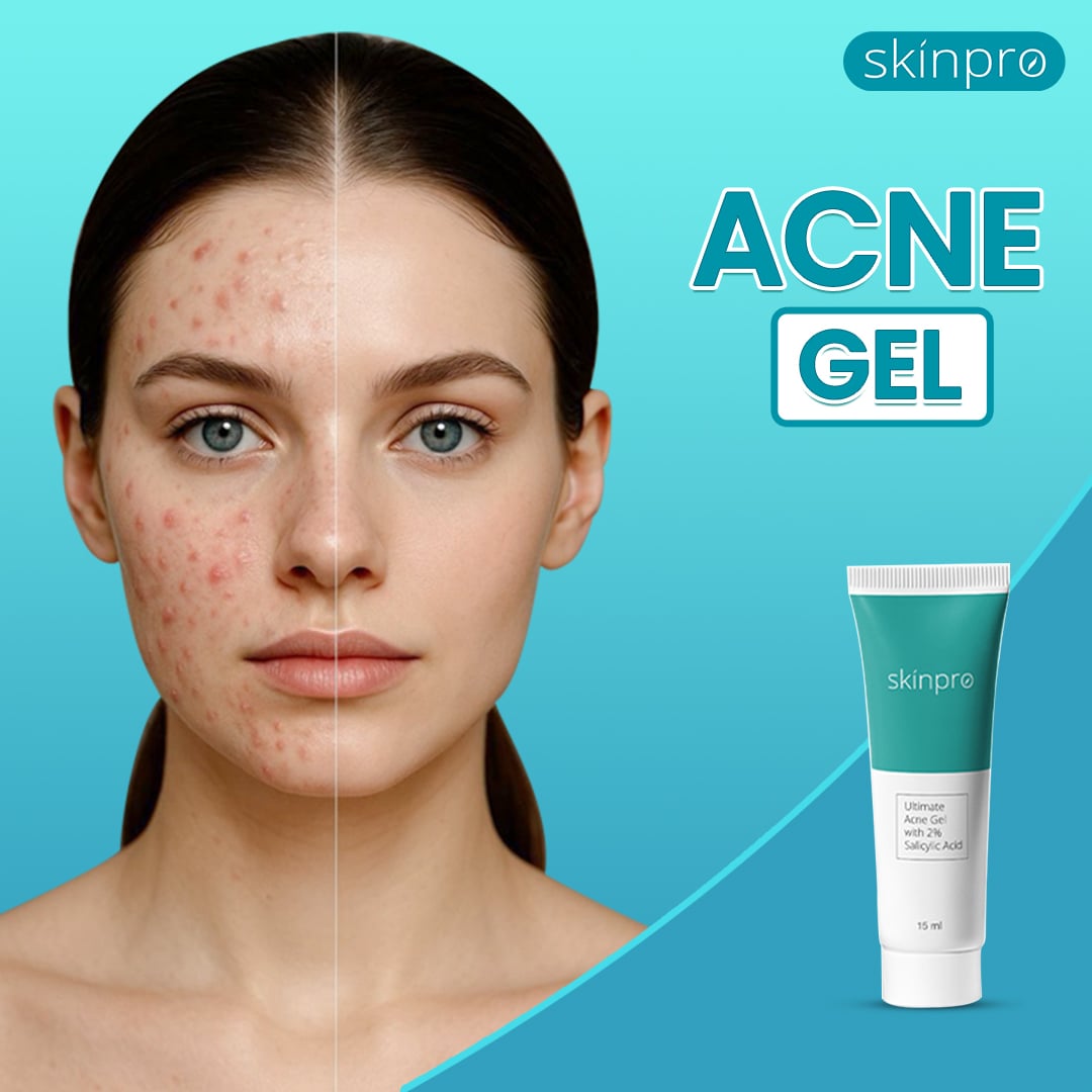 Picture of Skinpro Acne Clearing Gel Cleanser 50 ml and Skinpro Ultimate Acne Gel 15 ml Combo Blue