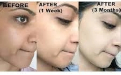 Picture of Frozen Collagen 2in1 Whitening Capsules-60pics