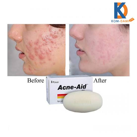 Picture of Stiefel Acne Aid Bar Pimple Prone & Oily Skin Acne Aid Soap 100g