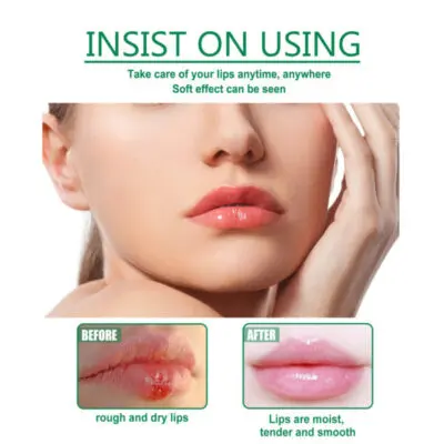 Picture of Herbal Medicated Lip Balm | Best Lip Balm for Dark Lips in Bangladesh- The Asia Express - Multicolor