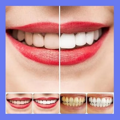 Picture of Yayashi sp-4 Probiotic Toothpaste freshen breath maintain oral health whiten teeth Stain Removing Sp-4 Toothpaste Teeth Cleaner Plaque Remove 