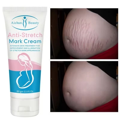 Picture of Aichun Beauty Anti-Stretch Marks Cream | Stretch Marks Removal Cream