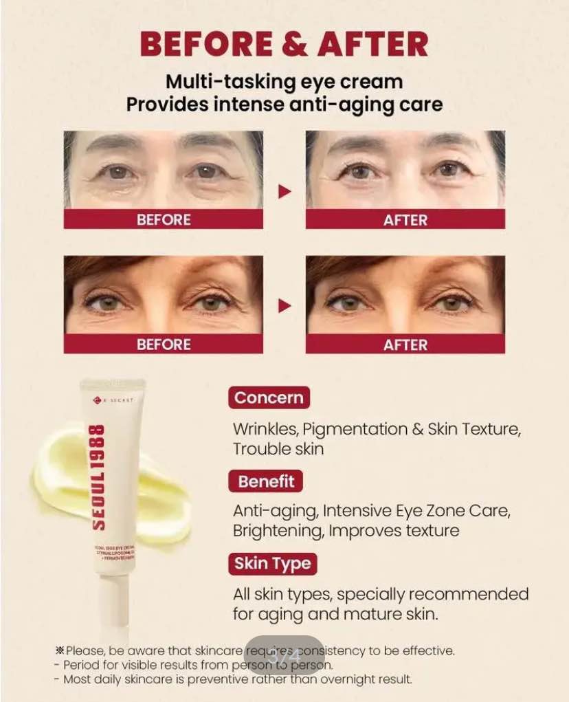 Picture of KSECRET SEOUL 1988 EYE CREAM : RETINAL LIPOSOME 4% + FERMENTED BEAN 30ML