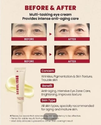Picture of KSECRET SEOUL 1988 EYE CREAM : RETINAL LIPOSOME 4% + FERMENTED BEAN 30ML