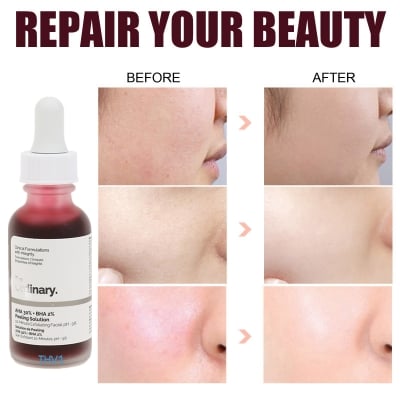 Picture of Peeling Solution AHA 30% + BHA 2% 30 MI